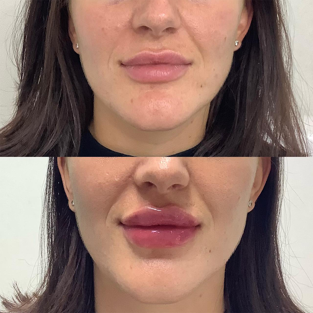 B&A 1
