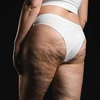 BODY FIRMING & CELLULITE