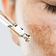 PIGMENTATION TREATMENTS