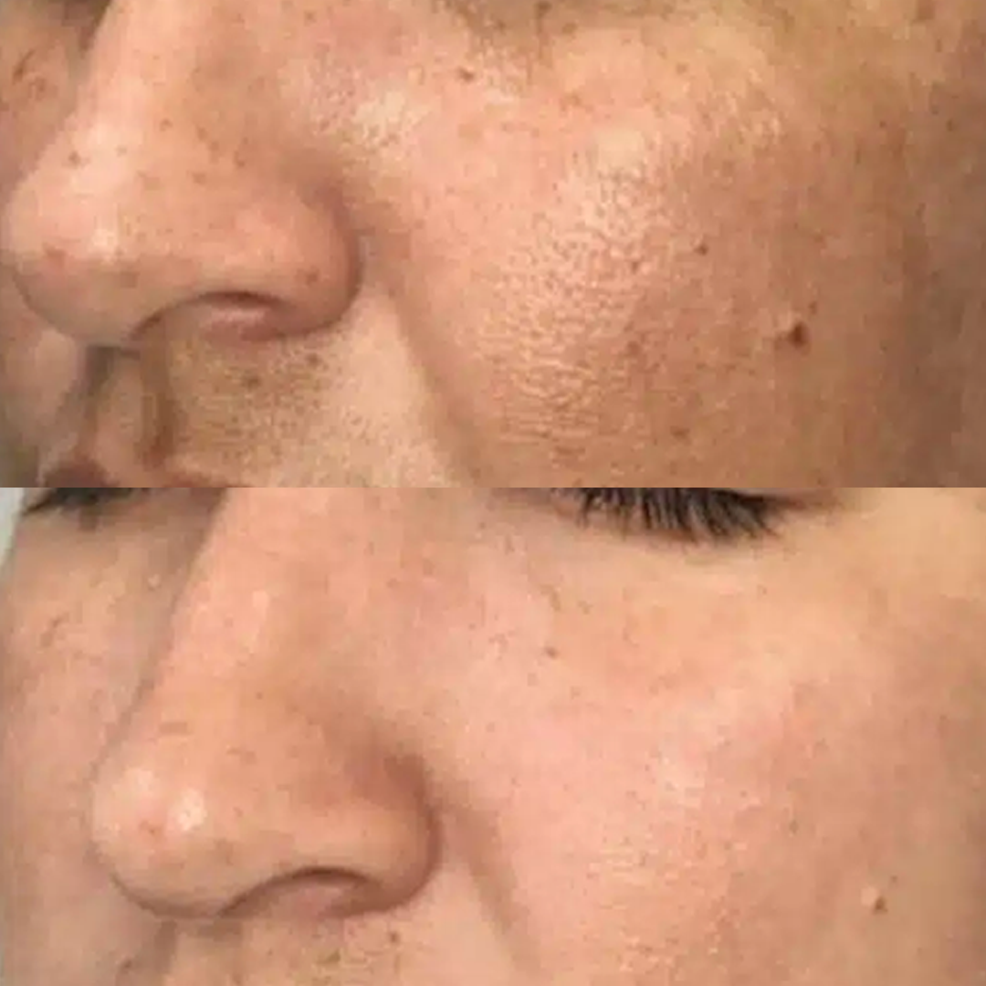 b&a 2