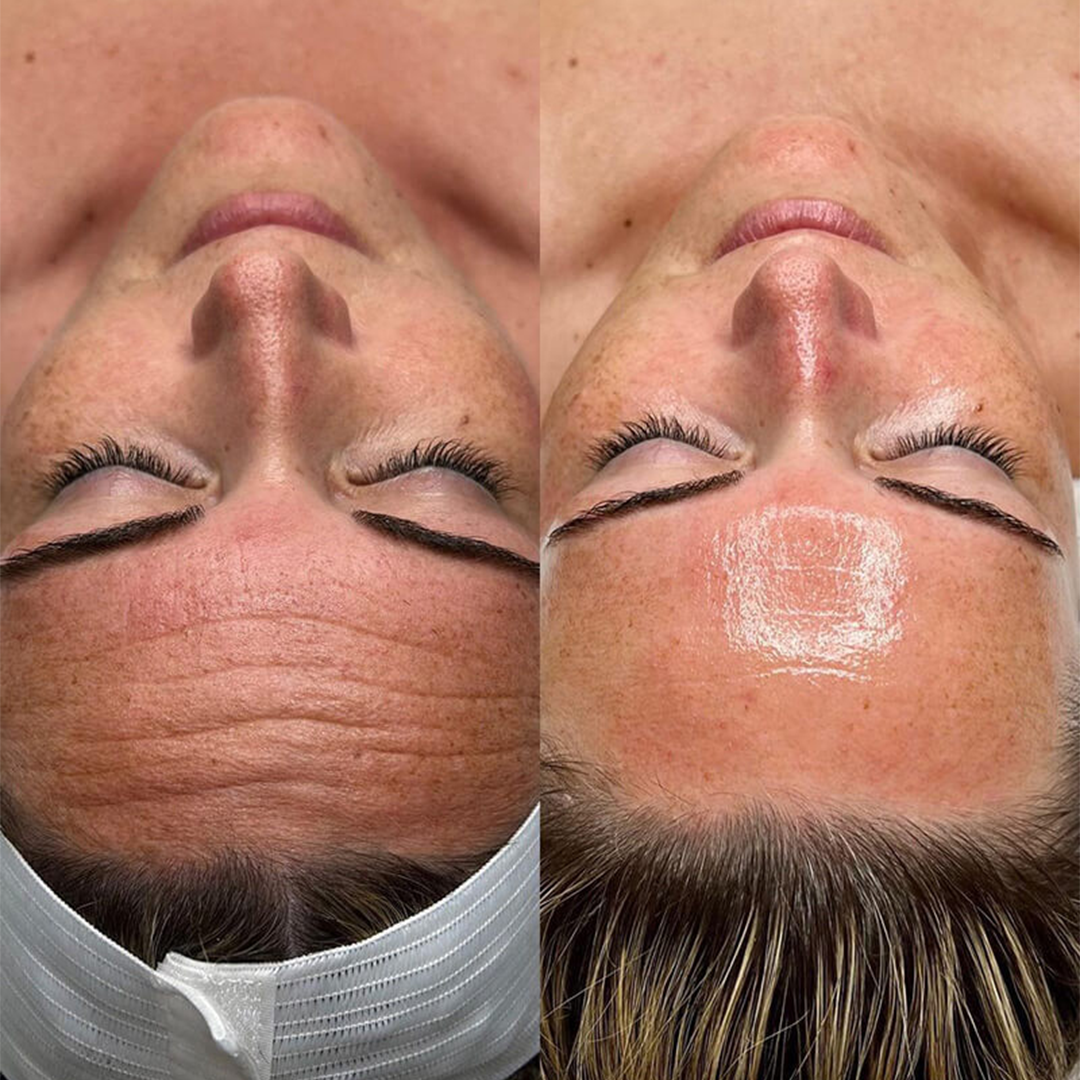 b&a 3